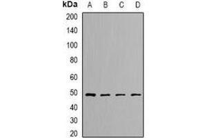 Western blot analysis of DLST expression in SKOV3 (A), Hela (B), mouse kidney (C), rat liver (D) whole cell lysates. (DLST antibody)