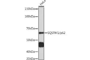 Western blot analysis of extracts of HeLa cells, using SQSTM1/p62 antibody (ABIN6128549, ABIN6148416, ABIN6148422 and ABIN6215126) at 1:1000 dilution. (SQSTM1 antibody  (AA 1-240))