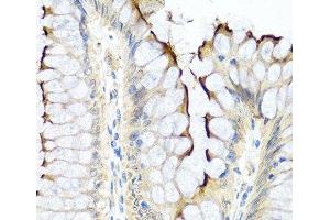 Immunohistochemistry of paraffin-embedded Human colon using INHBC Polyclonal Antibody at dilution of 1:100 (40x lens). (INHBC antibody)