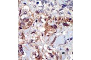 Image no. 2 for anti-Phosphatidylinositol-5-Phosphate 4-Kinase, Type II, alpha (PIP4K2A) (C-Term) antibody (ABIN360483) (PIP4K2A antibody  (C-Term))