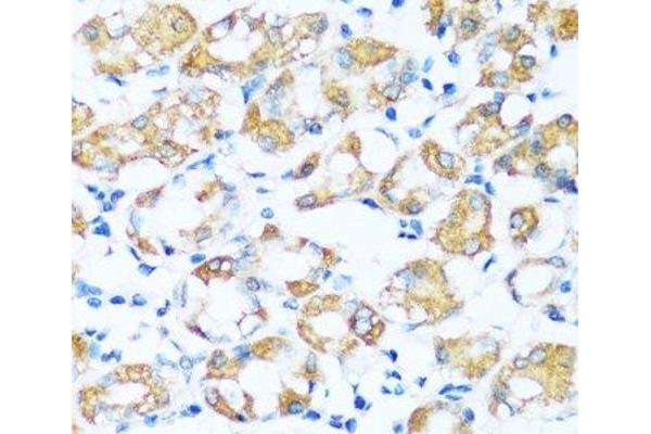 ARHGEF5 antibody