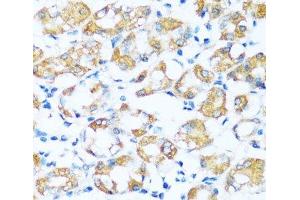 Immunohistochemistry of paraffin-embedded Human stomach using ARHGEF5 Polyclonal Antibody at dilution of 1:100 (40x lens).