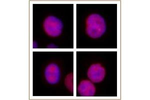 KLF5 antibody (pAb) tested by Immunofluorescence. (KLF5 antibody  (N-Term))
