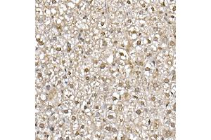 Immunohistochemistry of paraffin-embedded mouse liver using UB Rabbit mAb (ABIN7271128) at dilution of 1:50 (40x lens). (UBA52 antibody)