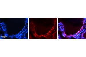 Rabbit Anti-GJA1 Antibody   Formalin Fixed Paraffin Embedded Tissue: Human Thyroid Gland Tissue Observed Staining: Plasma membrane Primary Antibody Concentration: 1:100 Other Working Concentrations: N/A Secondary Antibody: Donkey anti-Rabbit-Cy3 Secondary Antibody Concentration: 1:200 Magnification: 20X Exposure Time: 0. (Connexin 43/GJA1 antibody  (Middle Region))