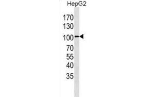 Western Blotting (WB) image for anti-Leucine-Rich Repeat Containing G Protein-Coupled Receptor 5 (LGR5) antibody (ABIN3001607) (LGR5 antibody)