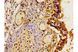 Immunohistochemistry of paraffin-embedded human lung tissue using ABIN7158808 at dilution of 1:100 (LAMP3 antibody  (AA 28-224))