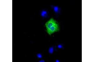 Image no. 4 for anti-Lipase, Endothelial (LIPG) antibody (ABIN1499162)