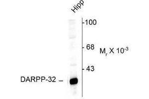 Image no. 1 for anti-Protein Phosphatase 1, Regulatory (Inhibitor) Subunit 1B (PPP1R1B) (N-Term) antibody (ABIN372605) (DARPP32 antibody  (N-Term))