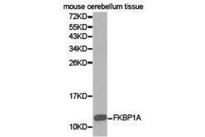 Western Blotting (WB) image for anti-FK506 Binding Protein 1A, 12kDa (FKBP1A) antibody (ABIN1872697) (FKBP1A antibody)