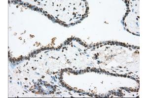 Image no. 1 for anti-Transforming, Acidic Coiled-Coil Containing Protein 3 (TACC3) antibody (ABIN1498099) (TACC3 antibody)
