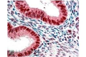 Image no. 1 for anti-Chromobox Homolog 5 (CBX5) (Internal Region) antibody (ABIN374617) (CBX5 antibody  (Internal Region))
