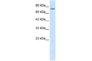 WB Suggested Anti-KCNN3 Antibody Titration:  0. (KCNN3 antibody  (C-Term))