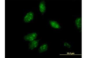 Immunofluorescence of purified MaxPab antibody to ANXA4 on HeLa cell. (Annexin IV antibody  (AA 1-321))