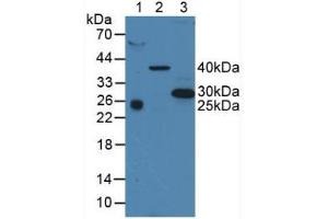 Western blot analysis of (1) Human Serum, (2) Porcine Liver Tissue and (3) Human A375 Cells. (CD63 antibody  (AA 103-203))