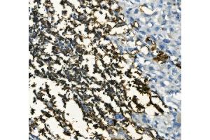IHC analysis of CD20/MS4A1 using anti-CD20/MS4A1 antibody (ABIN7599233).