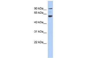CENTB5 antibody used at 1 ug/ml to detect target protein.