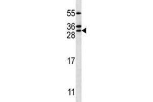RAB5C antibody western blot analysis in Jurkat lysate. (Rab5c antibody  (AA 178-207))