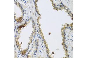 Immunohistochemistry of paraffin-embedded human prostate using GFER antibody.