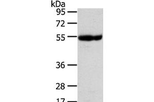 Western Blot analysis of Human placenta tissue using UBAP1 Polyclonal Antibody at dilution of 1/400 (UBAP1 antibody)