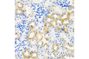 Immunohistochemistry of paraffin-embedded rat kidney using STC1 antibody (ABIN5975425) at dilution of 1/100 (40x lens). (Stanniocalcin 1 antibody)