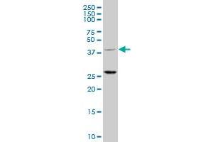 TRIM63 polyclonal antibody (A01), Lot # 051219JC01 Western Blot analysis of TRIM63 expression in HepG2 . (TRIM63 antibody  (AA 254-352))