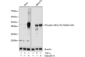 Western blot analysis of extracts of various cell lines, using Phospho-eIF2α-S51 Rabbit mAb (ABIN6135266, ABIN6136152, ABIN6136153 and ABIN7101882) at 1:1000 dilution. (EIF2S1 antibody  (pSer51))