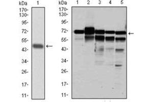 Western Blotting (WB) image for anti-Replication Protein A1, 70kDa (RPA1) antibody (ABIN1108896) (RPA1 antibody)