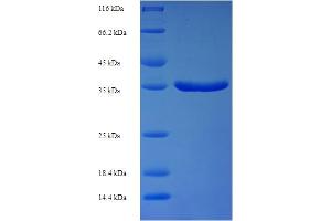 SDS-PAGE (SDS) image for Transforming Growth Factor, alpha (TGFA) (AA 24-97) protein (GST tag) (ABIN5710480)