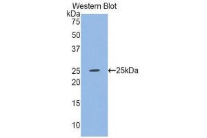 Western Blotting (WB) image for anti-Glutathione Synthetase (GSS) (AA 268-474) antibody (ABIN1859084) (Glutathione Synthetase antibody  (AA 268-474))