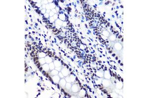 Immunohistochemistry of paraffin-embedded human colon using Phospho-IκBα-S36 Rabbit mAb (ABIN7268992) at dilution of 1:100 (40x lens). (NFKBIA antibody  (pSer36))