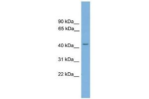 TSPYL6 antibody used at 1 ug/ml to detect target protein. (TSPY-Like 6 antibody  (N-Term))