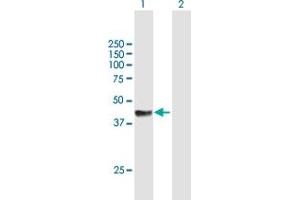Western Blot analysis of RAD51C expression in transfected 293T cell line by RAD51C MaxPab polyclonal antibody. (RAD51C antibody  (AA 1-376))