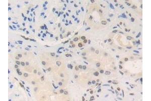 Immunohistochemistry (IHC) image for anti-High Mobility Group Nucleosomal Binding Domain 2 (HMGN2) (AA 2-81) antibody (ABIN7443026)