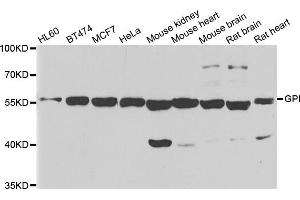 Western blot analysis of extracts of various cell lines, using GPI antibody.