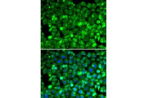 Immunofluorescence analysis of HeLa cell using RPLP1 antibody. (RPLP1 antibody)