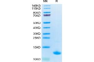 CXCL10 Protein (AA 27-91) (His tag)