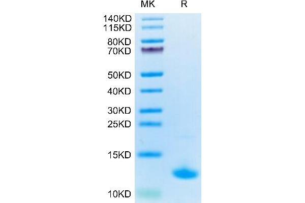 CXCL10 Protein (AA 27-91) (His tag)