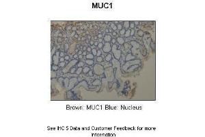Immunohistochemistry (IHC) image for anti-Mucin 1 (MUC1) (C-Term) antibody (ABIN2776819)