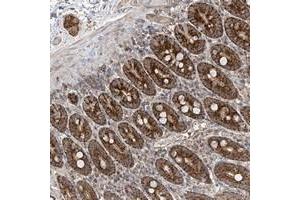Immunohistochemical staining of human duodenum with UQCC polyclonal antibody  shows strong granular cytoplasmic positivity in glandular cells at 1:200-1:500 dilution.