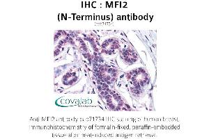 Image no. 1 for anti-Antigen P97 (Melanoma Associated) Identified By Monoclonal Antibodies 133.2 and 96.5 (MFI2) (N-Term) antibody (ABIN1736928) (MFI2 antibody  (N-Term))