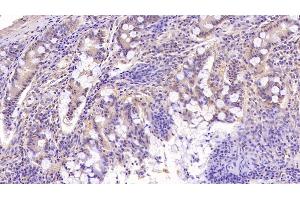 Detection of TFR in Human Small intestine Tissue using Monoclonal Antibody to Transferrin Receptor (TFR) (Transferrin Receptor antibody  (AA 567-744))