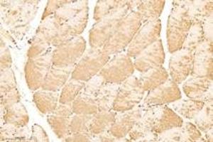 Immunohistochemistry analysis of paraffin-embedded rat skeletal muscle using,KPB1+2 (ABIN7074443) at dilution of 1: 3000 (KPB1/2 antibody)