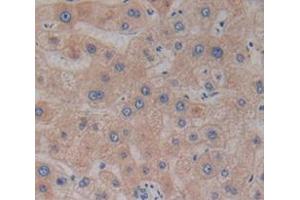 Immunohistochemistry (IHC) image for anti-alpha-2-HS-Glycoprotein (AHSG) (AA 19-300) antibody (ABIN1077777)