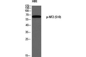 Western Blot (WB) analysis of HBE using p-NF2 (S10) antibody. (Merlin antibody  (pSer10))
