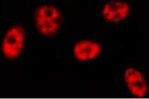 ABIN6274464 staining HeLa cells by IF/ICC. (BRF1 antibody  (Internal Region))