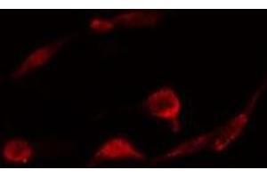 ABIN6278331 staining  A431 cells by IF/ICC. (PLCB3 antibody  (C-Term))