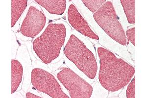 Human Skeletal Muscle: Formalin-Fixed, Paraffin-Embedded (FFPE). (NRF1 antibody  (N-Term))