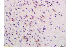 Formalin-fixed and paraffin embedded rat brain labeled with Anti Phospho-Cofilin (Ser3) Polyclonal Antibody , Unconjugated at 1:200, followed by conjugation to the secondary antibody and DAB staining (Cofilin antibody  (pSer3))