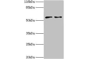 Western blot All lanes: CRISPLD2 antibody at 2 μg/mL Lane 1: Jurkat whole cell lysate Lane 2: CEM whole cell lysate Secondary Goat polyclonal to rabbit IgG at 1/10000 dilution Predicted band size: 56, 52, 43, 18, 14 kDa Observed band size: 56 kDa (CRISPLD2 antibody  (AA 40-305))